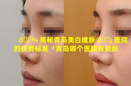 🌾 揭秘青岛美白嫩肤 🐡 医院的收费标准「青岛哪个医院有皮肤美容科」